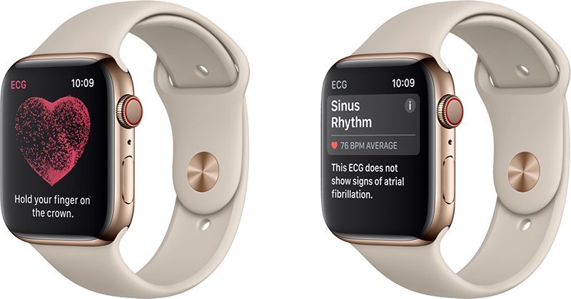 Apple Watch4心电图功能仅限美国 还要等到年底